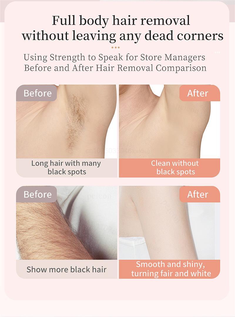 Épilateur Portable Double Tête - Boutique ÉclatsChic