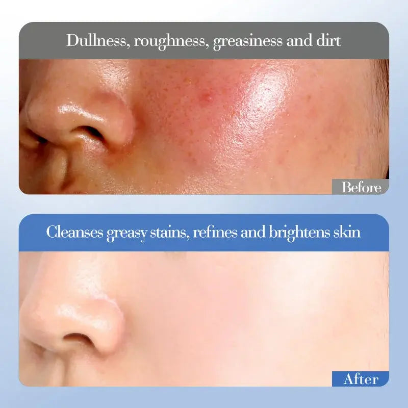 Crème visage hydratante niacinamide et au riz - Boutique ÉclatsChic